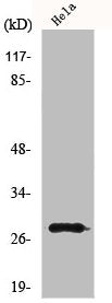 Western Blot analysis of HeLa cells using MRRF Polyclonal Antibody