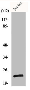 Western Blot analysis of Jurkat cells using Musculin Polyclonal Antibody