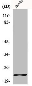 Western Blot analysis of Jurkat cells using MYL3 Polyclonal Antibody