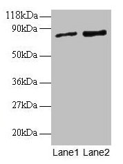 Western blot All lanes: RAB1A antibody at 2µg/ml Lane 1: EC109 whole cell lysate Lane 2: 293T whole cell lysate Secondary Goat polyclonal to rabbit IgG at 1/15000 dilution Predicted band size: 23, 16, 14 kDa Observed band size: 80 kDa