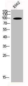 Western Blot analysis of K562 cells using N4BP1 Polyclonal Antibody