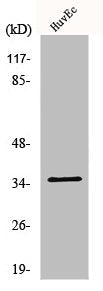 Western Blot analysis of Jurkat cells using Nanog P8 Polyclonal Antibody