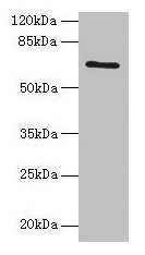 Western blot All lanes: HEATR9 antibody at 1.2µg/ml + Jurkat whole cell lysate Secondary Goat polyclonal to rabbit IgG at 1/10000 dilution Predicted band size: 66, 27, 61, 45, 40 kDa Observed band size: 66 kDa