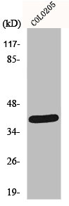 Western Blot analysis of COLO205 cells using NEGR1 Polyclonal Antibody