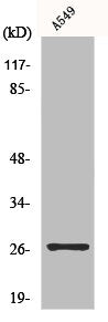 Western Blot analysis of A549 cells using NET-5 Polyclonal Antibody