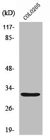 Western Blot analysis of HuvEc cells using Neurexophilin-4 Polyclonal Antibody