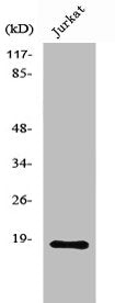 Western Blot analysis of MCF7 cells using Neuromedin-S Polyclonal Antibody