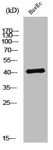 Western Blot analysis of Jurkat cells using Neurotrimin Polyclonal Antibody