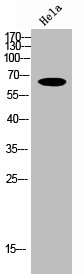 Western Blot analysis of Hela cells using NFκB-p65 Polyclonal Antibody