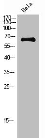 Western Blot analysis of Hela cells using NFκB-p65 Polyclonal Antibody