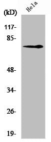 Western Blot analysis of HeLa cells using NGFR p75 Polyclonal Antibody