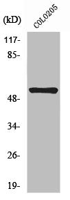 Western Blot analysis of COLO205 cells using NK-3R Polyclonal Antibody