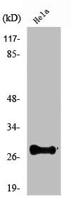 Western Blot analysis of COLO205 cells using Nkx-2.6 Polyclonal Antibody