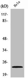 Western Blot analysis of HeLa cells using NM23-H1 Polyclonal Antibody
