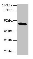 Western blot All lanes: C19orf47 antibody at 10µg/ml + Mouse muscle tissue Secondary Goat polyclonal to rabbit IgG at 1/10000 dilution Predicted band size: 45, 38, 30 kDa Observed band size: 45 kDa