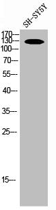 Western Blot analysis of SH-SY5Y cells using NOS2 Polyclonal Antibody