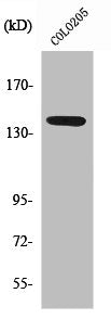Western Blot analysis of COLO205 cells using NOS3 Polyclonal Antibody