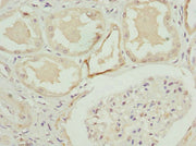 Immunohistochemistry of paraffin-embedded human kidney tissue using CSB-PA003490ESR2HU at dilution of 1:100