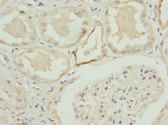 Immunohistochemistry of paraffin-embedded human kidney tissue using CSB-PA003490ESR2HU at dilution of 1:100