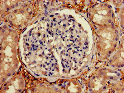Immunohistochemistry of paraffin-embedded human kidney tissue using CSB-PA003497LA01HU at dilution of 1:100