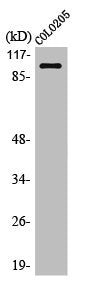 Western Blot analysis of COLO205 cells using OCRL Polyclonal Antibody