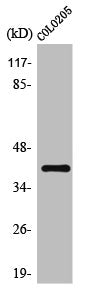 Western Blot analysis of COLO205 cells using Olfactory receptor 10D4 Polyclonal Antibody