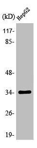 Western Blot analysis of Jurkat cells using Olfactory receptor 13H1 Polyclonal Antibody