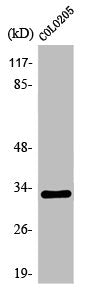 Western Blot analysis of COLO205 cells using Olfactory receptor 1B1 Polyclonal Antibody