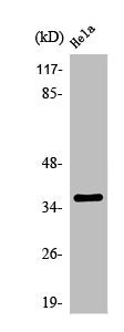 Western Blot analysis of COLO205 cells using Olfactory receptor 1D4/1D5 Polyclonal Antibody