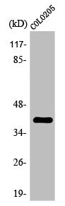Western Blot analysis of COLO205 cells using Olfactory receptor 2L5 Polyclonal Antibody