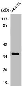 Western Blot analysis of HepG2 cells using Olfactory receptor 4A15 Polyclonal Antibody