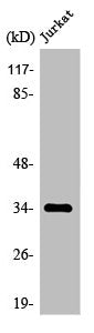 Western Blot analysis of Jurkat cells using Olfactory receptor 4C12 Polyclonal Antibody