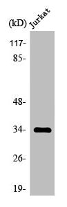 Western Blot analysis of Jurkat cells using Olfactory receptor 4D1 Polyclonal Antibody