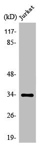 Western Blot analysis of Jurkat cells using Olfactory receptor 51D1 Polyclonal Antibody