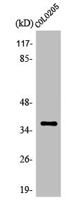 Western Blot analysis of HeLa cells using Olfactory receptor 52E5 Polyclonal Antibody