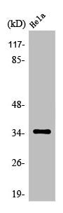 Western Blot analysis of MCF7 cells using Olfactory receptor 52E6 Polyclonal Antibody
