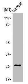 Western Blot analysis of MCF7 cells using Olfactory receptor 5D3 Polyclonal Antibody