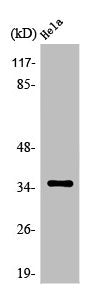 Western Blot analysis of Jurkat cells using Olfactory receptor 5F1 Polyclonal Antibody