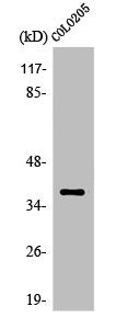 Western Blot analysis of Jurkat cells using Olfactory receptor 5K1 Polyclonal Antibody