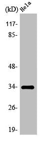 Western Blot analysis of COLO205 cells using Olfactory receptor 7C1 Polyclonal Antibody