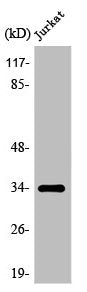 Western Blot analysis of COLO205 cells using Olfactory receptor 8D1 Polyclonal Antibody