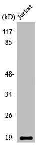 Western Blot analysis of Jurkat cells using Op18 Polyclonal Antibody