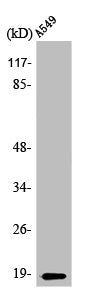 Western Blot analysis of HepG2 cells using Op18 Polyclonal Antibody