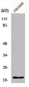 Western Blot analysis of COLO205 cells using p21 Polyclonal Antibody