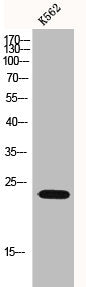 Western Blot analysis of K562 cells using p23 Polyclonal Antibody