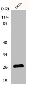 Western Blot analysis of COLO205 cells using p27 Polyclonal Antibody