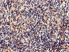 Immunohistochemistry of paraffin-embedded human spleen tissue using CSB-PA003637LA01HU at dilution of 1:100