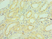Immunohistochemistry of paraffin-embedded human kidney tissue using CSB-PA003638ESR1HU at dilution of 1:100