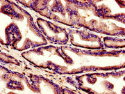 Immunohistochemistry of paraffin-embedded human prostate tissue using CSB-PA003641LA01HU at dilution of 1:100