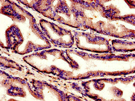 Immunohistochemistry of paraffin-embedded human prostate tissue using CSB-PA003641LA01HU at dilution of 1:100